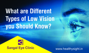 Eye Clinic in Noida